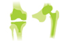Arthritis & Joint Replacement Clinic 